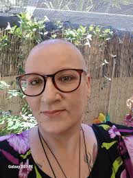 Is there a hairstylist that deals with women with alopecia?