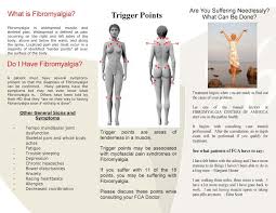 Frozen Shoulder Caused Fibromyalgia Fibromyalgia What Is Fibromyalgia Fibromyalgia Trigger Points