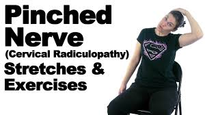 The natural course of cervical radiculopathy may be spontaneous resolution of symptoms within 5 years in 75% of cases (sor: Pinched Nerve Cervical Radiculopathy Stretches Exercises Ask Doctor Jo Youtube