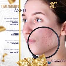 HarmoniCa es el bioestimulador híbrido que transforma tu piel desde adentro  hacia afuera. ✓ Mejora el contorno facial ✓ Eleva la calidad de tu piel ✓  Reduce la flacidez Descubre junto a
