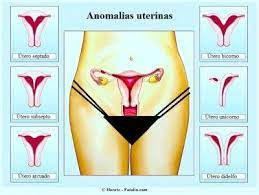 Utero Retrovertido Engravidar E Cirurgia Cirurgia Engravidar Fertilidade