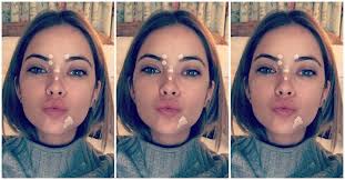 A great habit to get into in the mornings is drinking a glass of hot water with lemon, or take apple cider vinegar; How To Get Rid Of Acne 25 Skin Care Tips From Dermatologists Teen Vogue