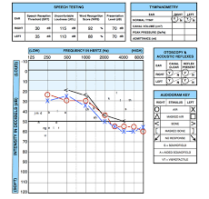 How Do I Read My Hearing Test The Hearing Clinic