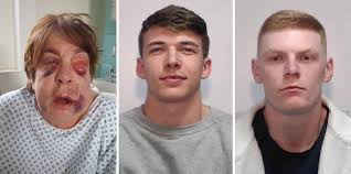 Thugs who broke every bone in defenceless grandmother's face are jailed  #Share #Justice A pair of thugs who broke every bone in a disabled  grandmother's face during a baseball bat attack have