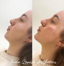 Jade Louise Aesthetics