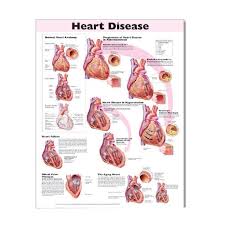 Heart Disease Laminated Anatomical Chart 2nd Edition