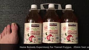 Nail fungus treatment does not have to be rigorous or even painful. Toenail Fungus 30 Day Experiment Using Apple Cider Vinegar Soak Youtube