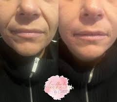 Aesthetics By Collette