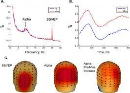 We did not find results for: A The Continuous Eeg Amplitude Spectrum Calculated Over Occipital Download Scientific Diagram