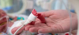 Com 21 Semanas Bebe Entra No Guinness Book Como O Mais Prematuro