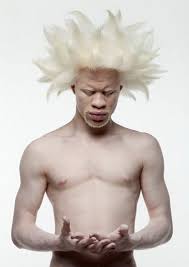 Hair Inspiration Part 2 Men Albino Men Natural Hair Styles Albino