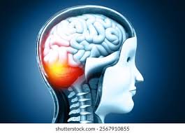 2+ Hundred Spinal Cord Injury Awareness Day Royalty-Free Images, Stock  Photos & Pictures