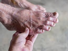 【講你知】起床踩地腳底痛爆！專家教「4招運動」舒緩及誘發「足底筋膜炎地雷」曝光