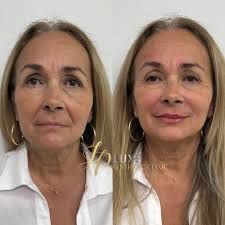 𝑱𝑷 𝑳𝒖𝒙𝒆 𝑨𝒆𝒔𝒕𝒉𝒆𝒕𝒊𝒄 𝑪𝒍𝒊𝒏𝒊𝒄