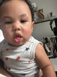 What could be causing my baby's face rash and how can I treat it?