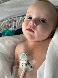 I'm out!! Coming out of anesthesia still little loopy.