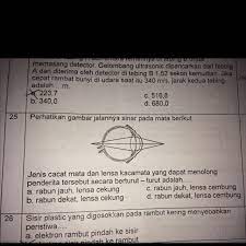 Jenis cacat mata dan kacamata apakah yang dapat menolong penderita cacat mata tersebut. Jenis Cacat Mata Dan Lensa Kacamata Yang Dapat Menolong Penderita Tersebut Secara Berturut Turut Brainly Co Id