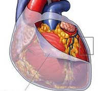 Image result for Pericardium