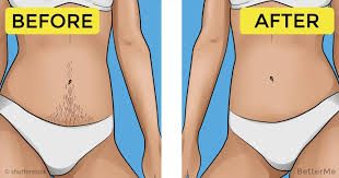 Get a pumice stone that is. Getting Rid Of Hair Line On Your Stomach Is Easy