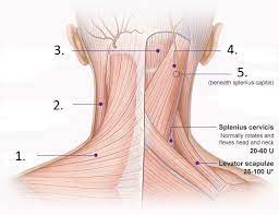 Check spelling or type a new query. Posterior Neck Muscles Diagram Quizlet
