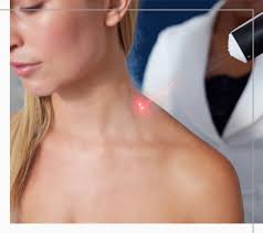 Spot CryotherapySPOT CRYO in Phoenix