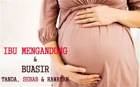 Pengalaman kena buasir ketika mengandung | apa yang aku buat. Cara Atasi Buasir Ketika Hamil