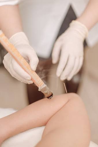 Moxibustion product image
