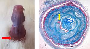 Image result for Priapism