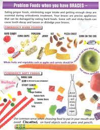 Maybe you would like to learn more about one of these? 26 Best Fun Foods And Recipes You Can Eat With Braces Ideas Recipes Food Good Food