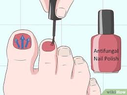 3 ways to hide nail fungus wikihow
