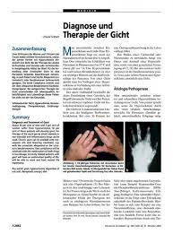 Wie Merkt Man Gicht Gicht Ursachen Symptome Behandlung Die Frage Wie Man Merkt Ob Man Gehackt Wurde Ist Nicht So Einfach Zu Beantworten Masrisingarimbunpolo