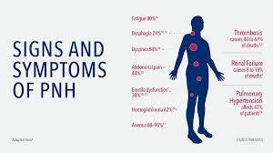 Feb 15, 1998 · orthopnea, paroxysmal nocturnal dyspnea, edema. Alexion On Twitter Dyk Fatigue Is The Overwhelming Symptom Of A Patient Living With Paroxysmal Nocturnal Hemoglobinuria Pnh An Ultra Rare Blood Disorder Learn The Facts About Pnh Here Https T Co Ndj6tws7ch Https T Co Fzhiygkayi
