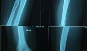 2 r jean mermoz, 83170 brignoles. Prise De Rendez Vous En Cabinet D Osteopathe Cabinet Osteopathe Osteopathie