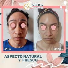 AURA Clinic Salud & Belleza.
