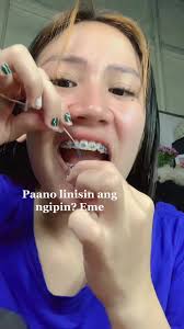 Replying to @Kaye Romano 🧶 sana tama na paglinis ko hahahah #braces #...