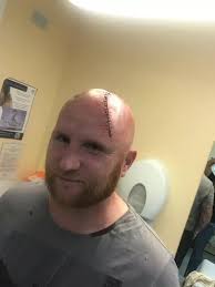 John Hartson recalls the incident that left him fearing for his life as  blood covered his whole body