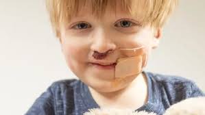 Fundraiser by Sophia Apostolou : Help support Em&Dasha's EB bandage fund.