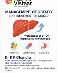 Image result for Obesity Management