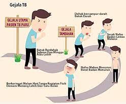 § batuk berdarah atau berkahak. Temukan Obati Sampai Sembuh Toss Tbc Radarsukabumi Com