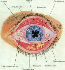 Image result for Ciliary Flush