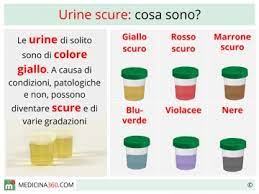 Quando il calcio viene consumato con alimenti ad alto contenuto di ossalati, l'acido ossalico nell'intestino si. Ossalato Di Calcio Nelle Urine