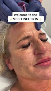 New treatment alert 🚨 #mesotox #microtox #mesoinfusion #microinfusion