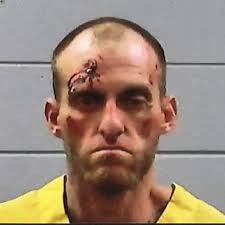 Stories of Alleged Brutality by a Mississippi Sheriff's Department