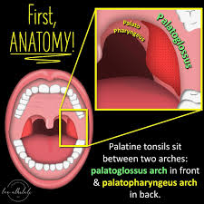 Image result for Peritonsillar Abscess