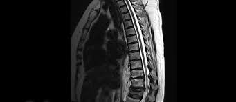 Mrt Lunge Brustkorb Radiologie Nuklearmedizin Adickesallee