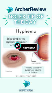 Image result for Hyphema
