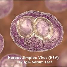 Image result for Herpes Simplex Virus Testing