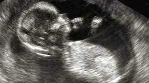 Semana 14 De Embarazo Tu Bebe Ya Hace Gestos