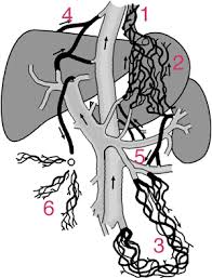 Check spelling or type a new query. Lebertransplantation Bei Alkohol Toxischer Leberzirrhose Vergiftungen Die Leber