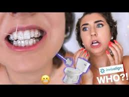 Most people start noticing some movement, however, within the first two months after getting their first set of aligner trays. I Got Invisalign Does Invisalign Work Storytime Youtube